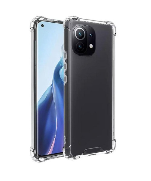 Unbreak Back Cover Σιλικόνης Διάφανο Για XIAOMI MI 11 Unbreak Back Cover Σιλικόνης Διάφανο Για XIAOMI MI 11
